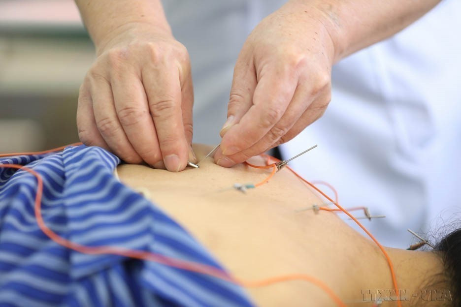 . Utilisation de l’électroacupuncture à l’hôpital provincial de médecine traditionnelle de Lang Son. Photo : VNA