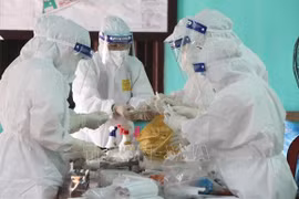 COVID-19: 88 nouveaux cas confirmés dans le bilan actualisé à midi ​