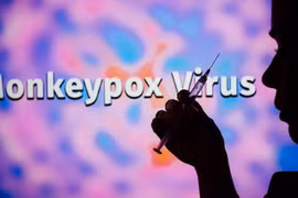 Le Vietnam n'enregistre pas de cas de Monkeypox (variole du singe)