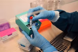 Vinmec a développé avec succès deux kits de dépistage du SARS-CoV-2
