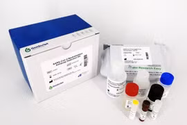 Singapour développe un kit de test rapide du coronavirus 