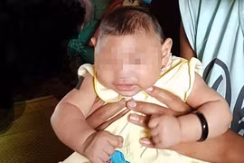 Le Vietnam annonce un premier cas d’enfant atteint d’une microcéphalie