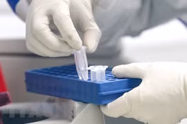 COVID-19 : Hanoï recherche et teste de toute urgence les cas contacts du Japonais décédé
