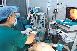 De nouvelles technologies au service de l’endoscopie médicale