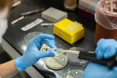 Des tests de résistance aux antimicrobiens sont effectués dans un laboratoire situé à Buenos Aires, en Argentine. Photo: OMS