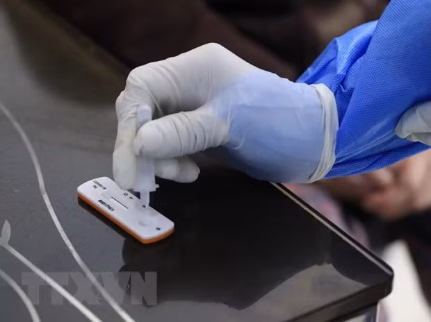 COVID-19: Le total s’établit à plus de 2,31 millions de cas confirmés ảnh 1 COVID-19: Le total s’établit à plus de 2,31 millions de cas confirmés ảnh 1