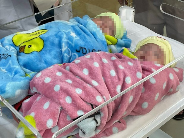 Des jumeaux survivent après une naissance prématurée, ne pesant que 500 g ảnh 1 Des jumeaux survivent après une naissance prématurée, ne pesant que 500 g ảnh 1