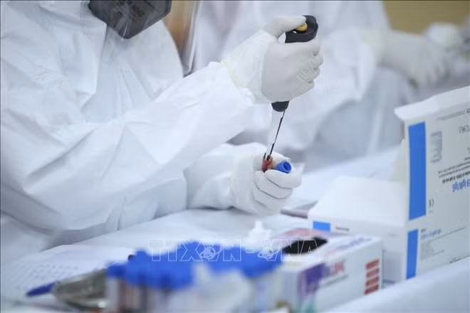 COVID-19: 641 nouveaux cas détectés le 28 octobre ảnh 1