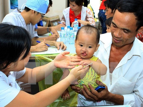 Bec-de-lièvre : opérations gratuites pour des enfants d’ethnies minoritaires ảnh 1 Bec-de-lièvre : opérations gratuites pour des enfants d’ethnies minoritaires ảnh 1