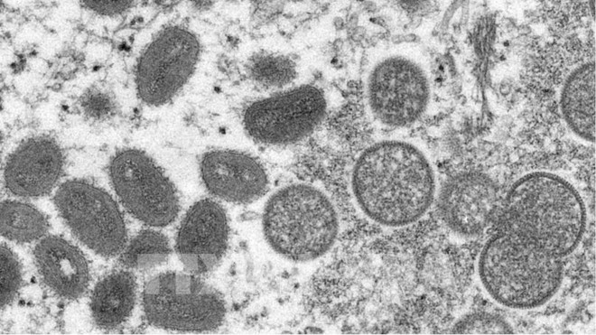 Le Vietnam n’a enregistré aucun cas de variole du singe ảnh 2 Le Vietnam n’a enregistré aucun cas de variole du singe ảnh 2