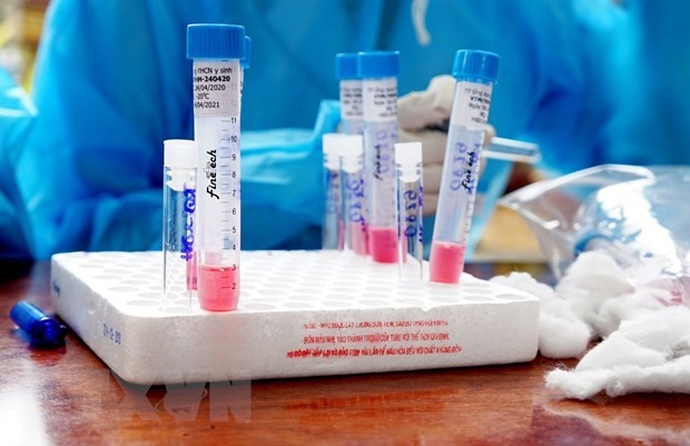 Dix-huit nouveaux cas supplémentaires de COVID-19 à la fin du 4 août ảnh 1 Dix-huit nouveaux cas supplémentaires de COVID-19 à la fin du 4 août ảnh 1