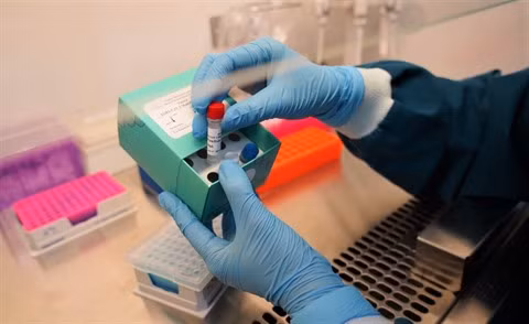 Vinmec a développé avec succès deux kits de dépistage du SARS-CoV-2 ảnh 1 Vinmec a développé avec succès deux kits de dépistage du SARS-CoV-2 ảnh 1