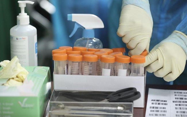 COVID-19 : plus de 4.800 nouveaux cas enregistrés ce mercredi matin ảnh 1 COVID-19 : plus de 4.800 nouveaux cas enregistrés ce mercredi matin ảnh 1