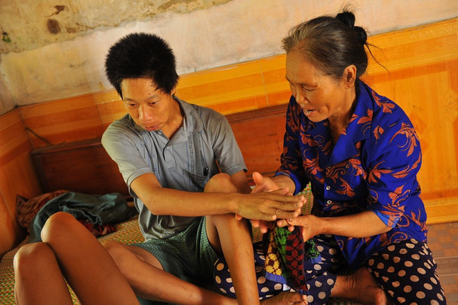 La douleur silencieuse causée par la dioxine au Vietnam, 43 ans après la fin de la guerre ảnh 2 La douleur silencieuse causée par la dioxine au Vietnam, 43 ans après la fin de la guerre ảnh 2