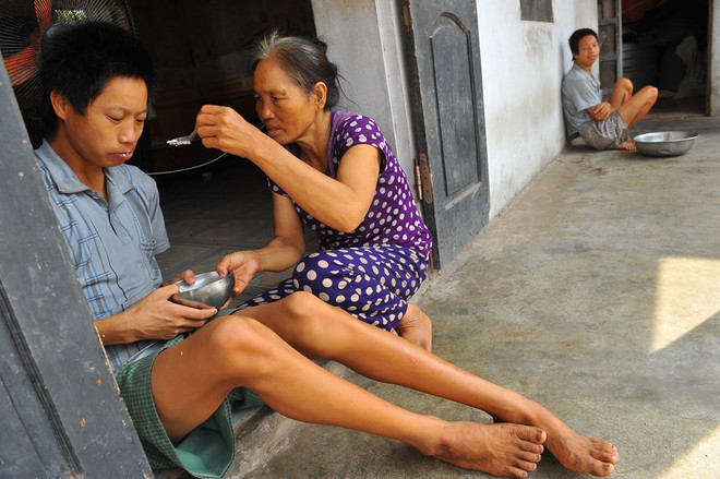 La douleur silencieuse causée par la dioxine au Vietnam, 43 ans après la fin de la guerre ảnh 4 La douleur silencieuse causée par la dioxine au Vietnam, 43 ans après la fin de la guerre ảnh 4