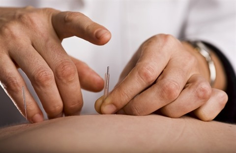 L’acupuncture au service de l’autisme infantile ảnh 1 L’acupuncture au service de l’autisme infantile ảnh 1