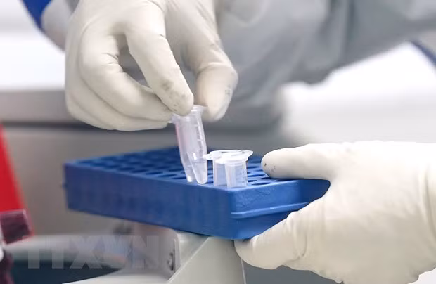 COVID-19 : Hanoï recherche et teste de toute urgence les cas contacts du Japonais décédé ảnh 1