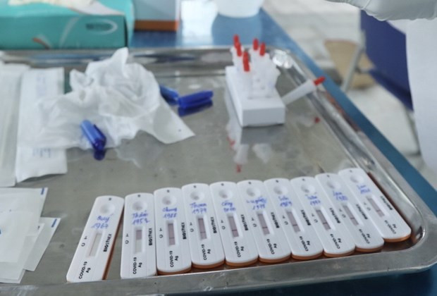 COVID-19: 1.785 nouveaux cas détectés en 24 heures ảnh 1