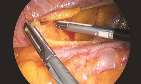 Endoscopie chirurgicale au Vietnam, une référence mondiale ảnh 2 Endoscopie chirurgicale au Vietnam, une référence mondiale ảnh 2