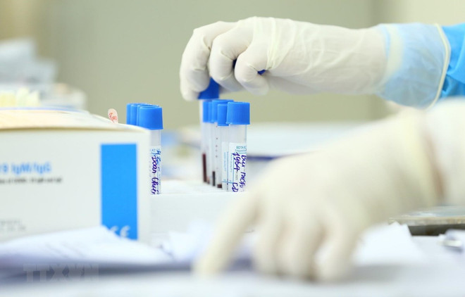 Covid-19 : 22 nouveaux cas signalés au Vietnam ảnh 1