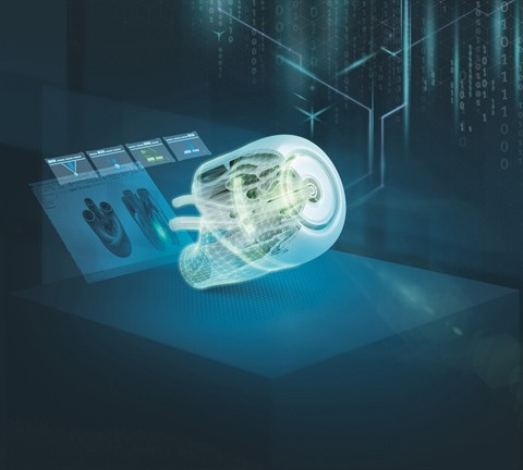 Siemens stimule la production de dispositifs médicaux anti-épidémiques ảnh 1 Siemens stimule la production de dispositifs médicaux anti-épidémiques ảnh 1