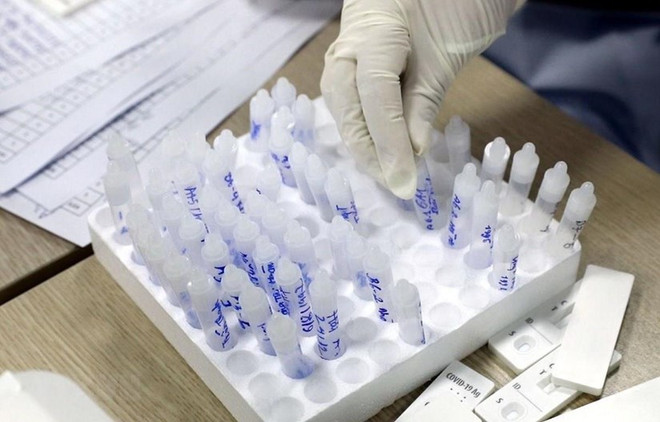 COVID-19 : 31 nouveaux cas confirmés mercredi matin ảnh 1 COVID-19 : 31 nouveaux cas confirmés mercredi matin ảnh 1