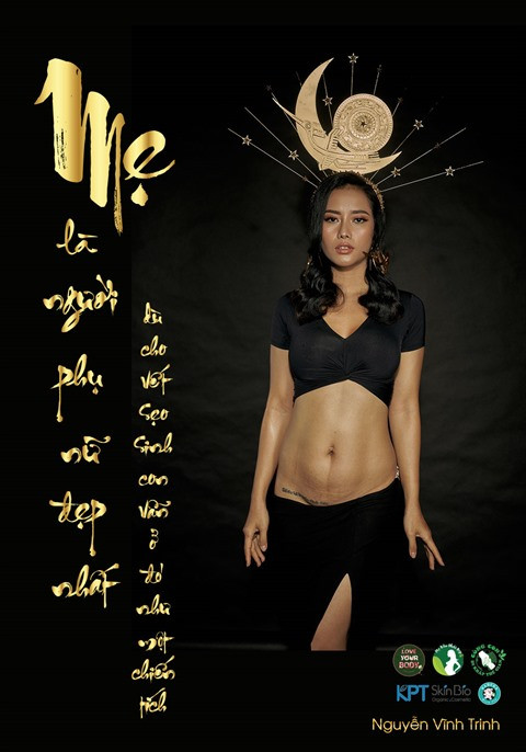 Exposition de photos "Mère est la plus belle des femmes" ảnh 1