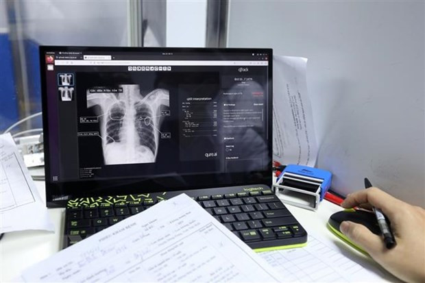 Lancement du jeu interactif « Guerrier contre la tuberculose » ảnh 2 Lancement du jeu interactif « Guerrier contre la tuberculose » ảnh 2