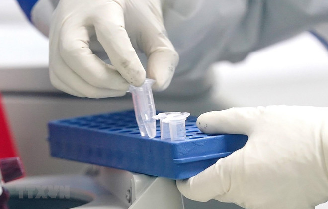 Le Japon aide l'Institut Pasteur de Ho Chi Minh-Ville à répondre à COVID-19 ảnh 1 Le Japon aide l'Institut Pasteur de Ho Chi Minh-Ville à répondre à COVID-19 ảnh 1