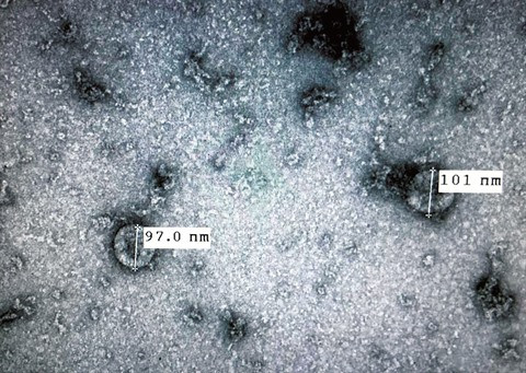 Mise en culture du coronavirus : une avancée majeure pour le Vietnam ảnh 1 Mise en culture du coronavirus : une avancée majeure pour le Vietnam ảnh 1