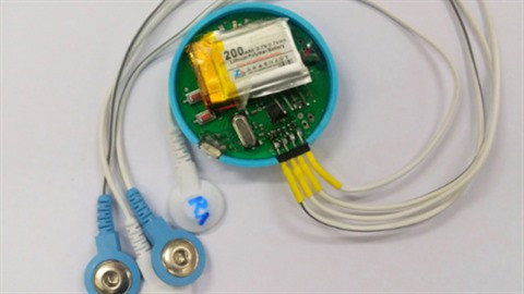 Cù Gia Huy, créateur d’un électrocardiogramme vietnamien ảnh 2 Cù Gia Huy, créateur d’un électrocardiogramme vietnamien ảnh 2