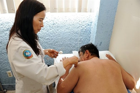Acupuncture au Mexique, une médecine qui a du piquant ảnh 1 Acupuncture au Mexique, une médecine qui a du piquant ảnh 1