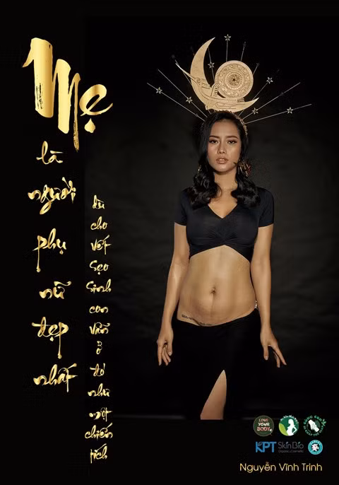 Exposition de photos "Mère est la plus belle des femmes" ảnh 1