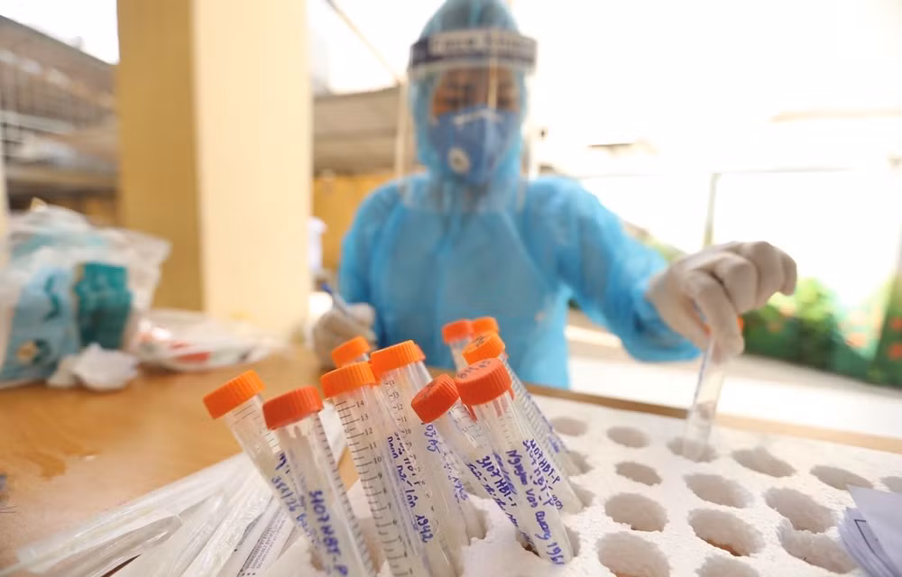 COVID-19 : 4.564 nouveaux cas confirmés samedi soir ảnh 1