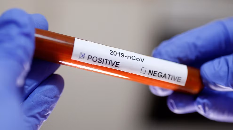  Production réussie de bioproduits de test rapide ELISA: une nouvelle étape pour le Vietnam ảnh 1