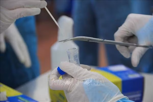 Le ministère de la Santé va réduire 30% des prix des tests COVID-19 ảnh 1