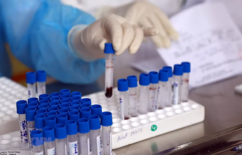 COVID-19 : 942 patients sont déclarés guéris ảnh 1