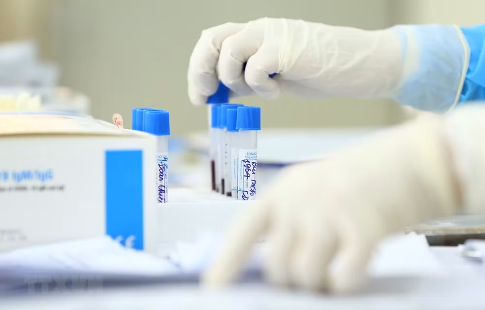 Covid-19 : 22 nouveaux cas signalés au Vietnam ảnh 1