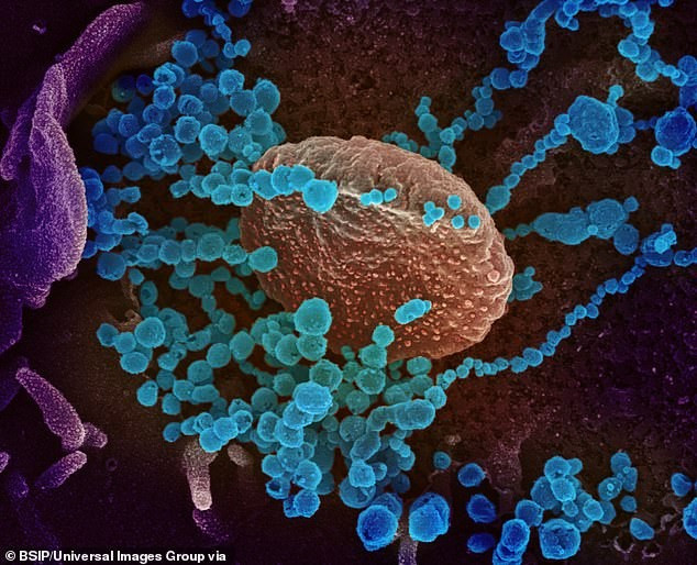 Image au microscope d’une cellule infectée par le virus SARS-CoV-2. Photo d’archives : BSIP