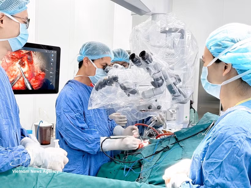 Le Docteur Nguyên Thanh Xuân réalise une opération chirurgicale crânienne. Photo: VNA