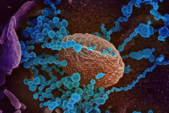 Image au microscope d’une cellule infectée par le virus SARS-CoV-2. Photo d’archives : BSIP