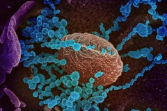 Image au microscope d’une cellule infectée par le virus SARS-CoV-2. Photo d’archives : BSIP