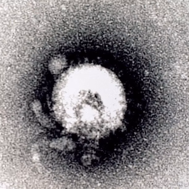 Le Vietnam a la capacité de tester et de détecter toutes les maladies infectieuses émergentes à ce jour, dont le H5N1, l'Ebola et les nouveaux virus Corona... Photo : VNA