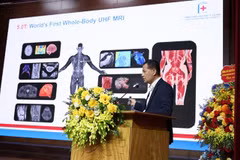 Le professeur associé Lê Tuân Linh, directeur adjoint de l’Hôpital universitaire de médecine de Hanoi et directeur du Centre d’imagerie diagnostique, évoque les capacités supérieures du système d’IRM 5T. Photo fournie par l’hôpital