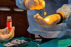 La greffe de cornée (kératoplastie) est une chirurgie oculaire cruciale remplaçant un tissu cornéen opaque ou endommagé par une greffe saine provenant d'un donneur décédé. Photo: tuoitre.vn