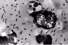 La bactérie Yersinia pestis, responsable de la peste, dont la forme la plus courante est la peste bubonique, se transmet généralement par la piqûre de puces infectées. Photo : Centres pour le contrôle et la prévention des maladies (CDC) des États-Unis.