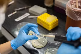 Des tests de résistance aux antimicrobiens sont effectués dans un laboratoire situé à Buenos Aires, en Argentine. Photo: OMS
