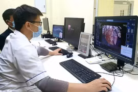 Le ministère de la Santé recommande aux unités de déployer l’intelligence artificielle et d’autres technologies pour soutenir le diagnostic, le traitement et la prévention des maladies. Photo : suckhoedoisong.vn