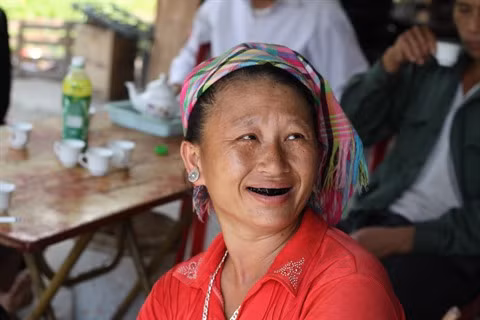 Le laquage des dents ảnh 2