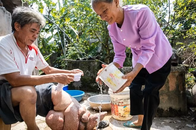 Le Vietnam a réussi à éliminer la filariose lymphatique ảnh 1